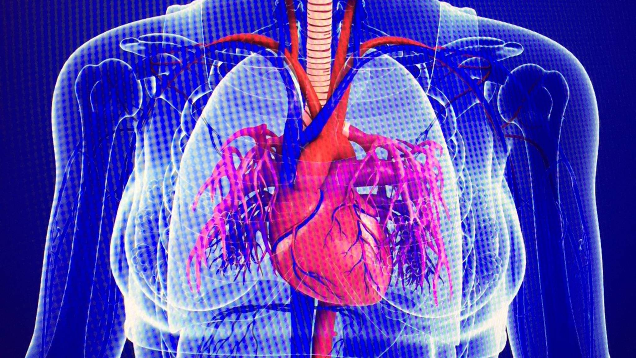 'Te weinig cardiologen hebben verstand van het vrouwenhart' | Nieuwsuur