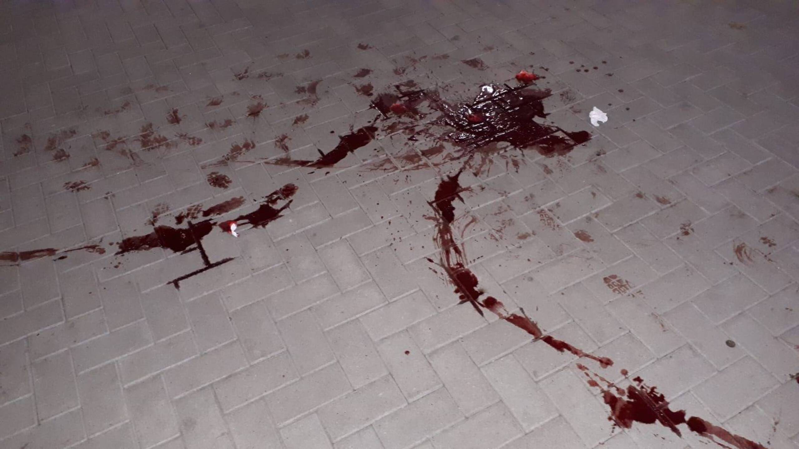 Vrouw tot bloedens toe gebeten door hond in parkeergarage | NOS