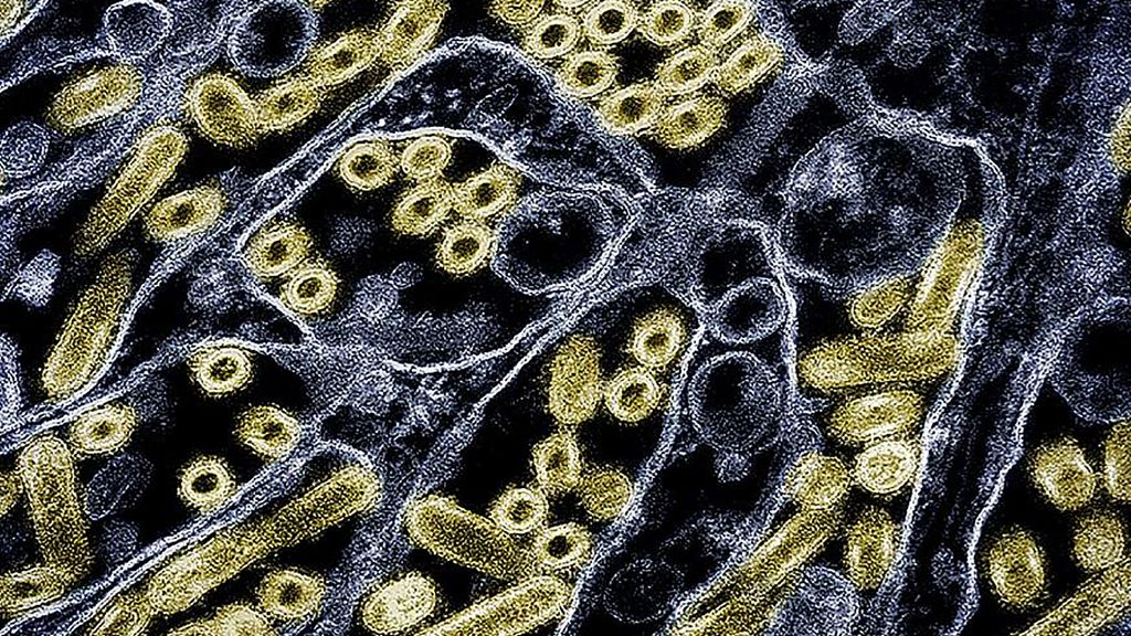 メキシコで鳥インフルエンザH5N2変異株による初の死亡が報告される
