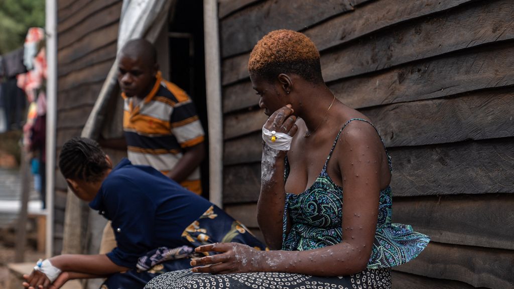 Vanavond op tv: Geen Nederlandse mpox-vaccins naar Afrika? • Nieuwe