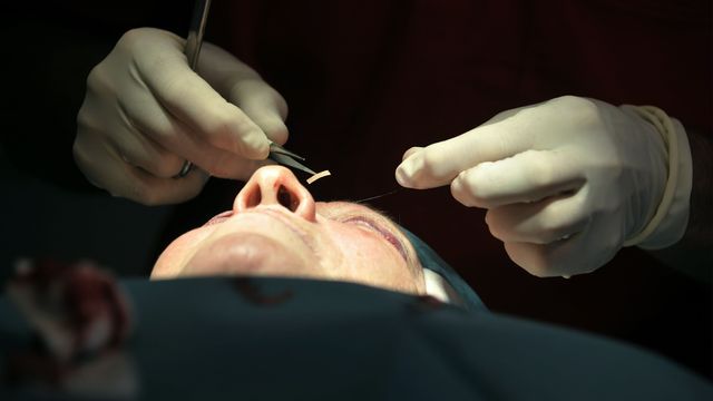 Eyelid Correction Surgery