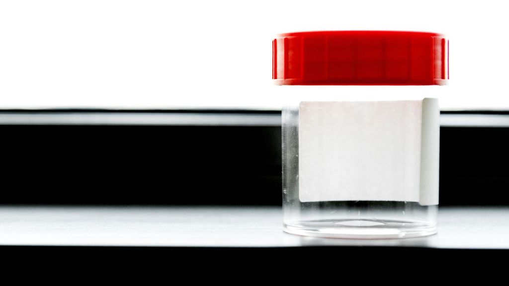 Foto: Schikking getroffen in zaak rond ongewenst ivf-sperma ziekenhuis Rijnstate 