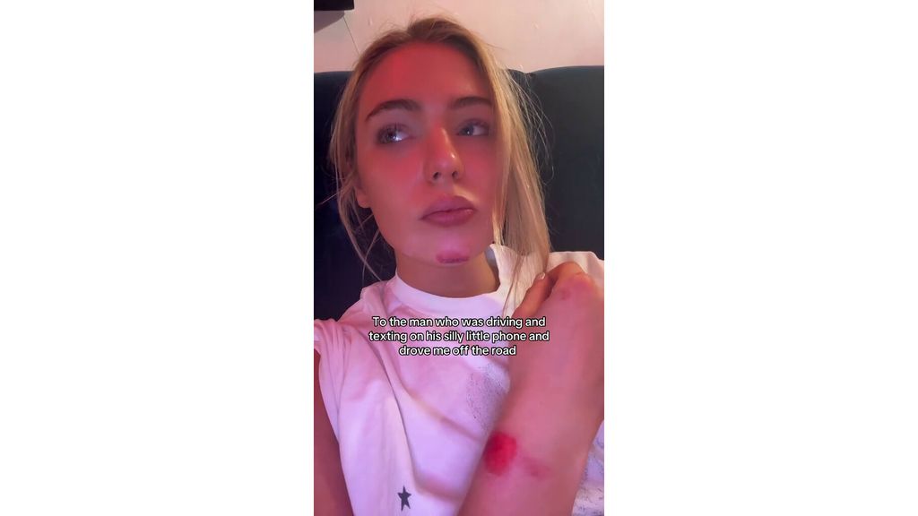 Leerdam toont verwondingen in TikTok-bericht