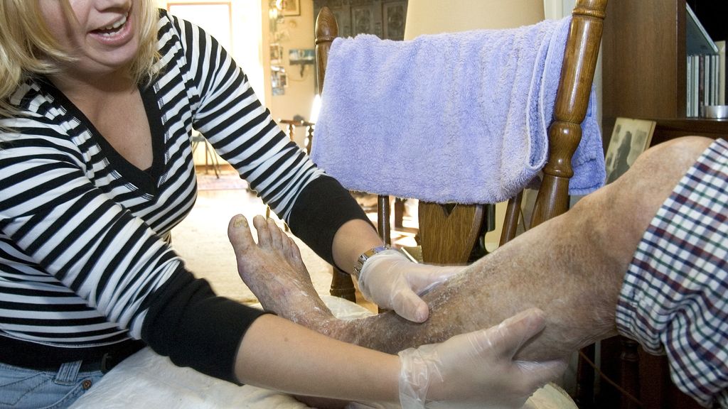 Foto: RIVM: medicijnen tegen schimmels minder effectief door schimmelbestrijding landbouw