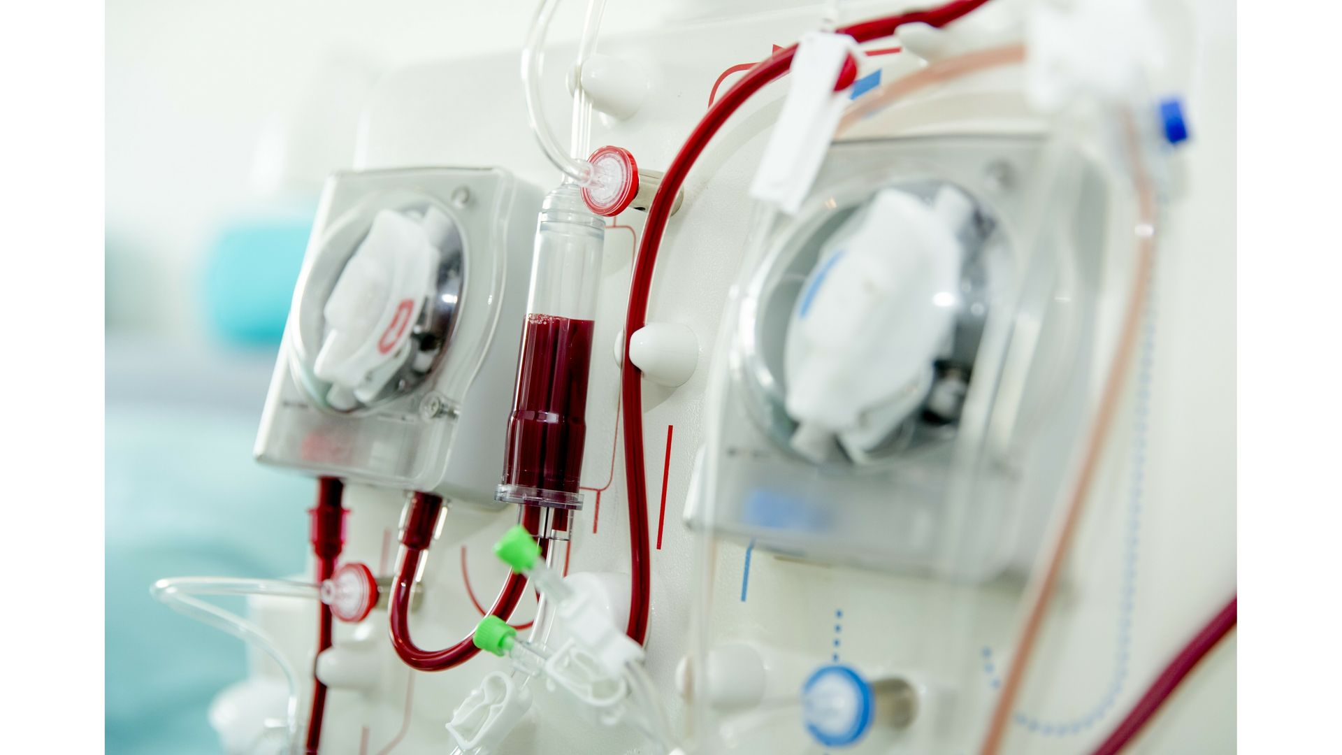 Met draagbare kunstnier wil Nierstichting patiënten weer vrijheid geven