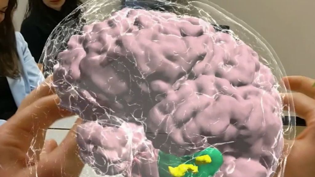 Foto: Amsterdam UMC voert hersenoperatie uit met behulp van hologram