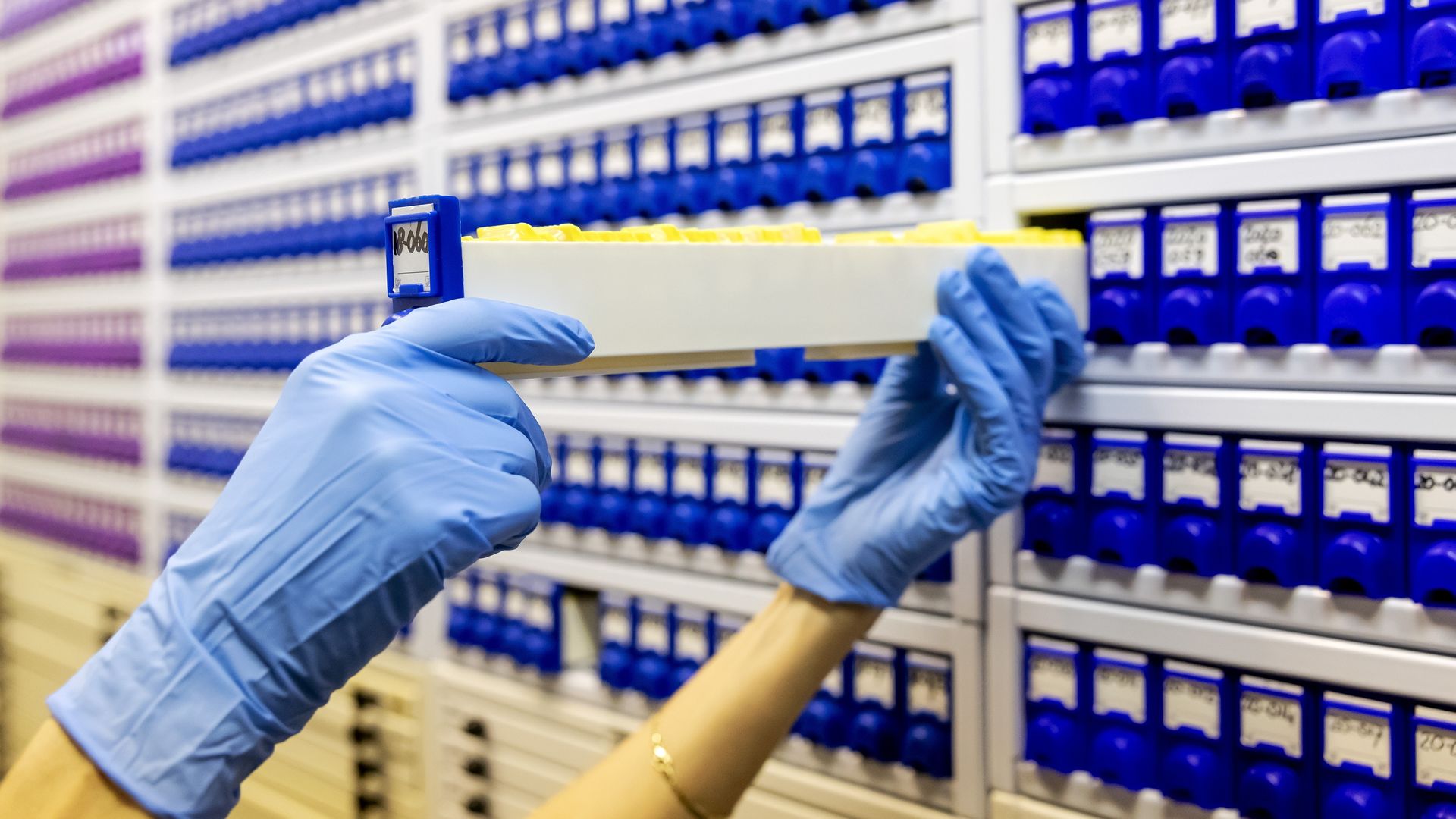 Zorginstituut: medicijn tegen alzheimer werkt niet goed genoeg voor vergoeding